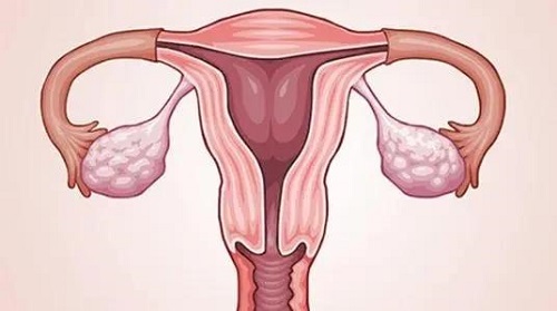 试管婴儿治疗最常见的一些适应症是什么？
