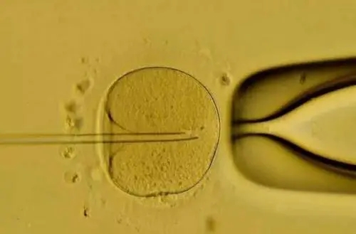 试管婴儿胚胎要达到什么标准才可以移植？