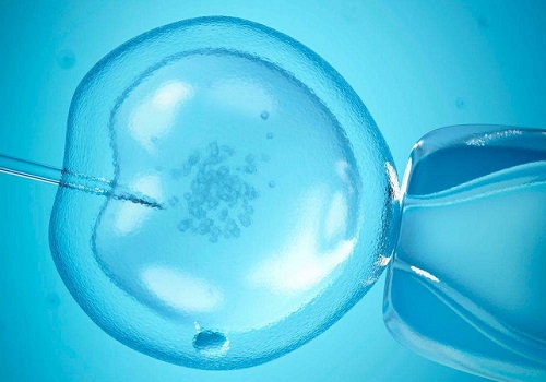 美国试管婴儿染色体检查费用是多少？