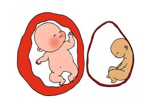 试管婴儿最大的缺点是？有钱就能解决